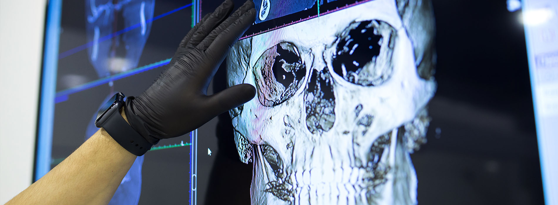 North Georgia Oral and Facial Surgery | Sinus Lift, Sedation and Corrective Jaw Surgery